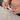 What are the risks with a TENS machine? - The Birth Store